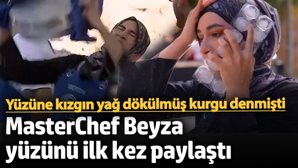 yuzune kizgin yag dokulmus kurgu denmisti masterchef beyza yuzunu ilk kez paylasti jhquy6EE