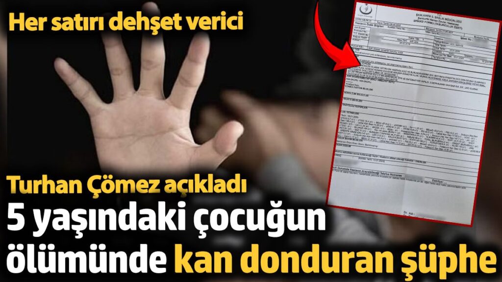 5 yasindaki cocugun olumunde kan donduran suphe turhan comez acikladi D165584t