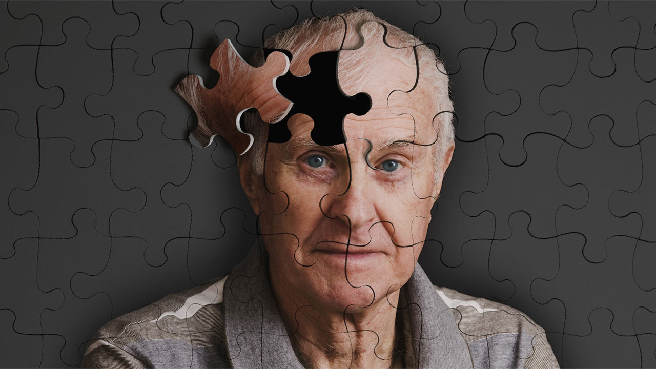 alzheimer tedavisinde devrim bilim insanlari yeni bir donemin esiginde 1 OX3v4Wv6