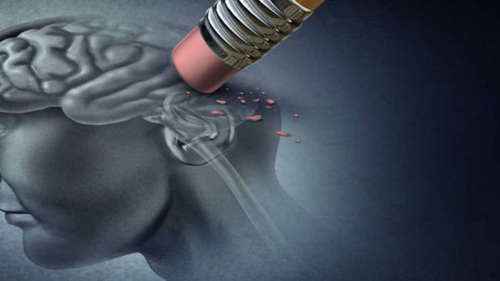 alzheimer tedavisinde devrim bilim insanlari yeni bir donemin esiginde 3 VAtf8wEf