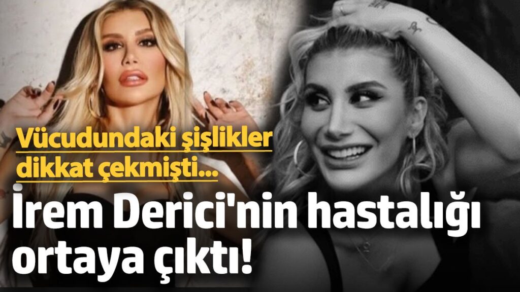 dudaginda ve kafasindaki sislikler dikkat cekti irem derici hastaligini acikladi XNf9W8XS