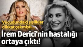 dudaginda ve kafasindaki sislikler dikkat cekti irem derici hastaligini acikladi XNf9W8XS