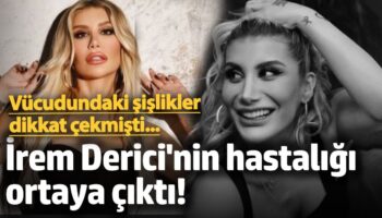 dudaginda ve kafasindaki sislikler dikkat cekti irem derici hastaligini acikladi XNf9W8XS