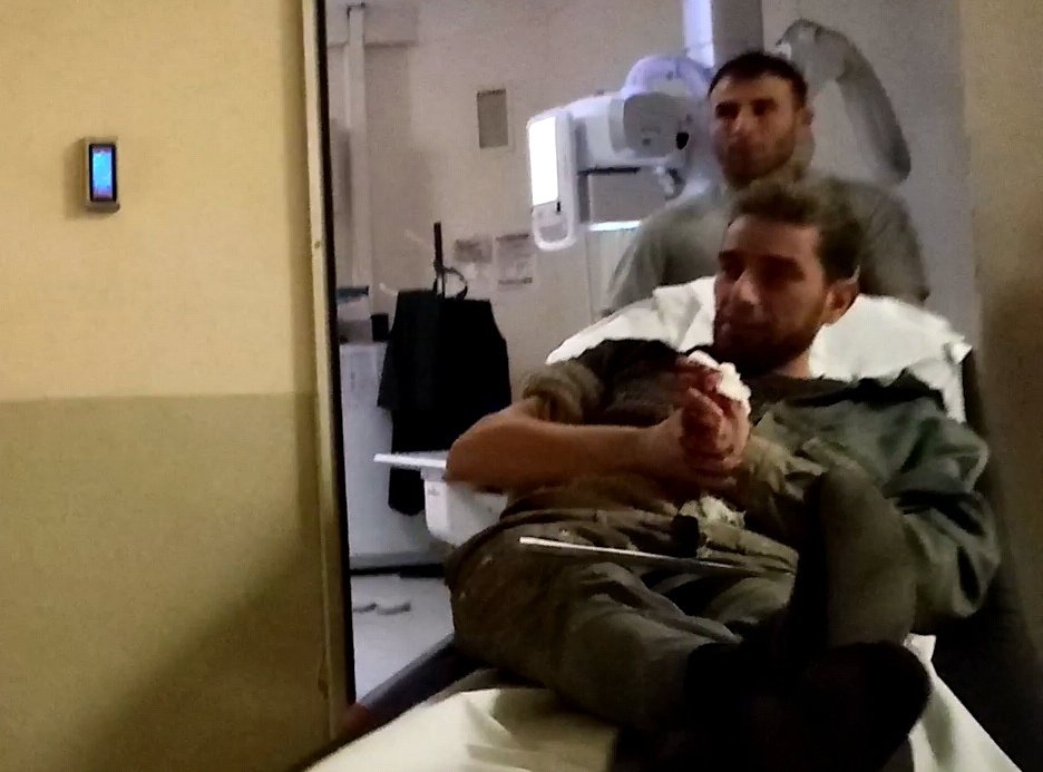 elini makineye kaptiran iscinin parmagi koptu 2 uSmg8pOd