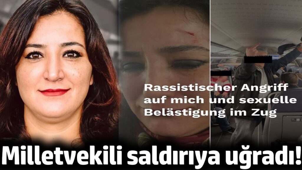 milletvekili saldiriya ugradi kWEhu64r