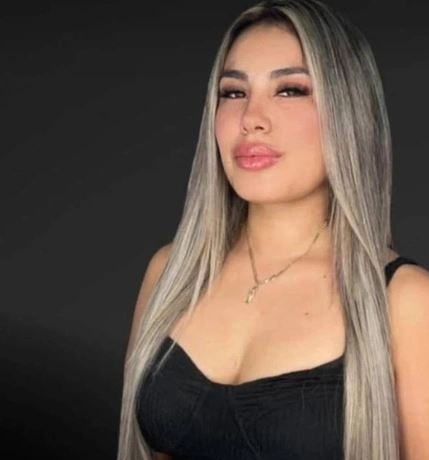 sosyal medya fenomeni asli fern ndez hayatini kaybetti bir estetik kurbani daha 1 HkFRcWuZ