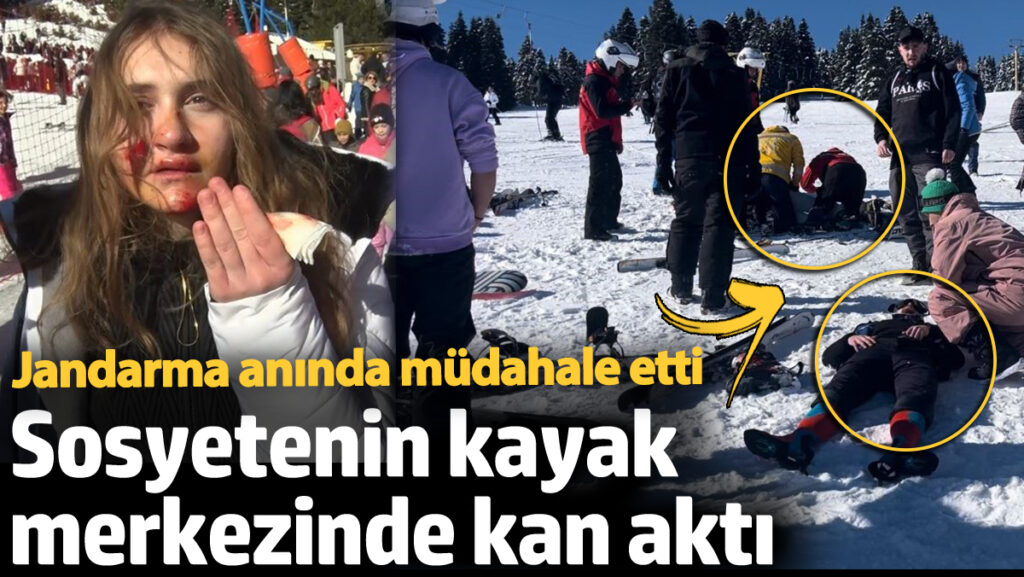 sosyetenin kayak merkezinde kan akti jandarma aninda mudahale etti fnuf3NiB