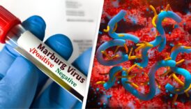 tanzanya hukumetinden marburg virusu hakkinda aciklama geldi l74KKlNT