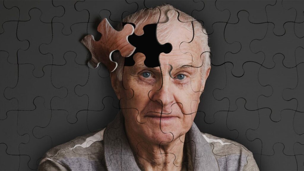 alzheimera yeni bir umut tedavide cigir acan gelisme NstsKCbg