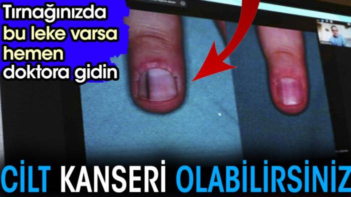 cildi genclestiren dogal mucize kirisikliklari azaltiyor cilt lekelerini yok ediyor 1 2AbwzcXT