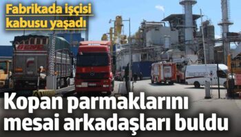 fabrikada iscisi kabusu yasadi kopan parmaklarini mesai arkadaslari buldu wnWGGlCS