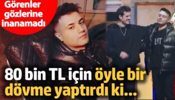 gorenler gozlerine inanamadi 80 bin tl icin oyle bir dovme yaptirdi ki IkCxLy47