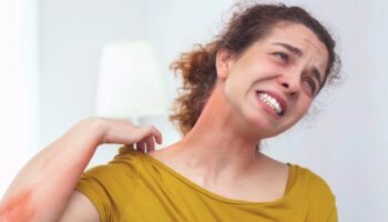 kasinan yeri kasimanin gorunmeyen tehlikeleri cilt doktorlarindan uyarilar 99BCpqzg