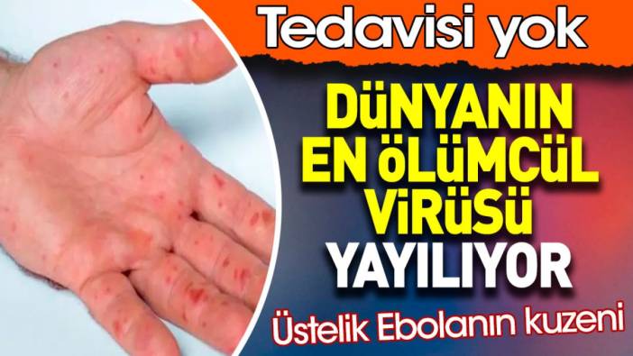 nijeryada ebola alarmi yayilma riski var 2 s8BLqHZM