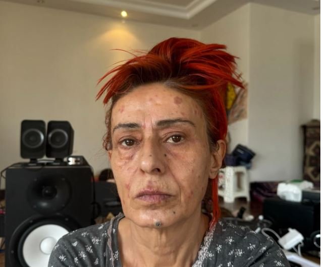 yildiz tilbenin son halini gorenler gozlerine inanamadi 0 tF6zTw1v