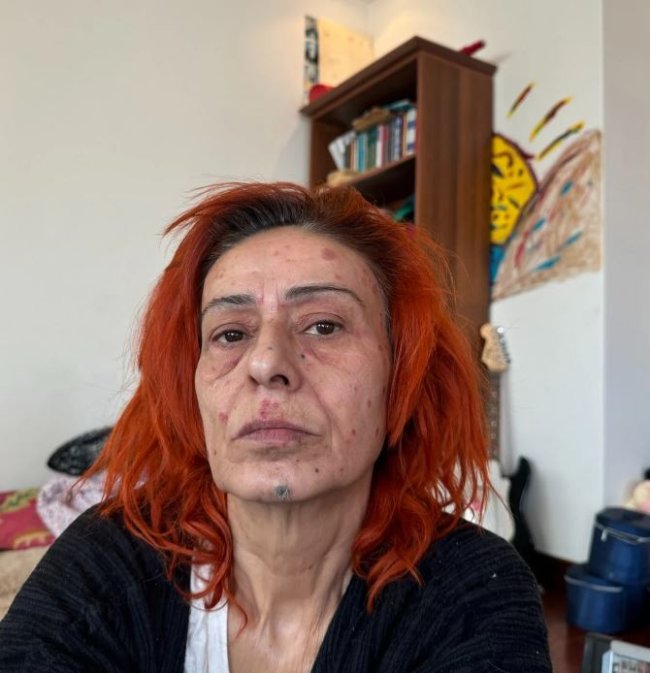 yildiz tilbenin son halini gorenler gozlerine inanamadi 1 6daHVkk5