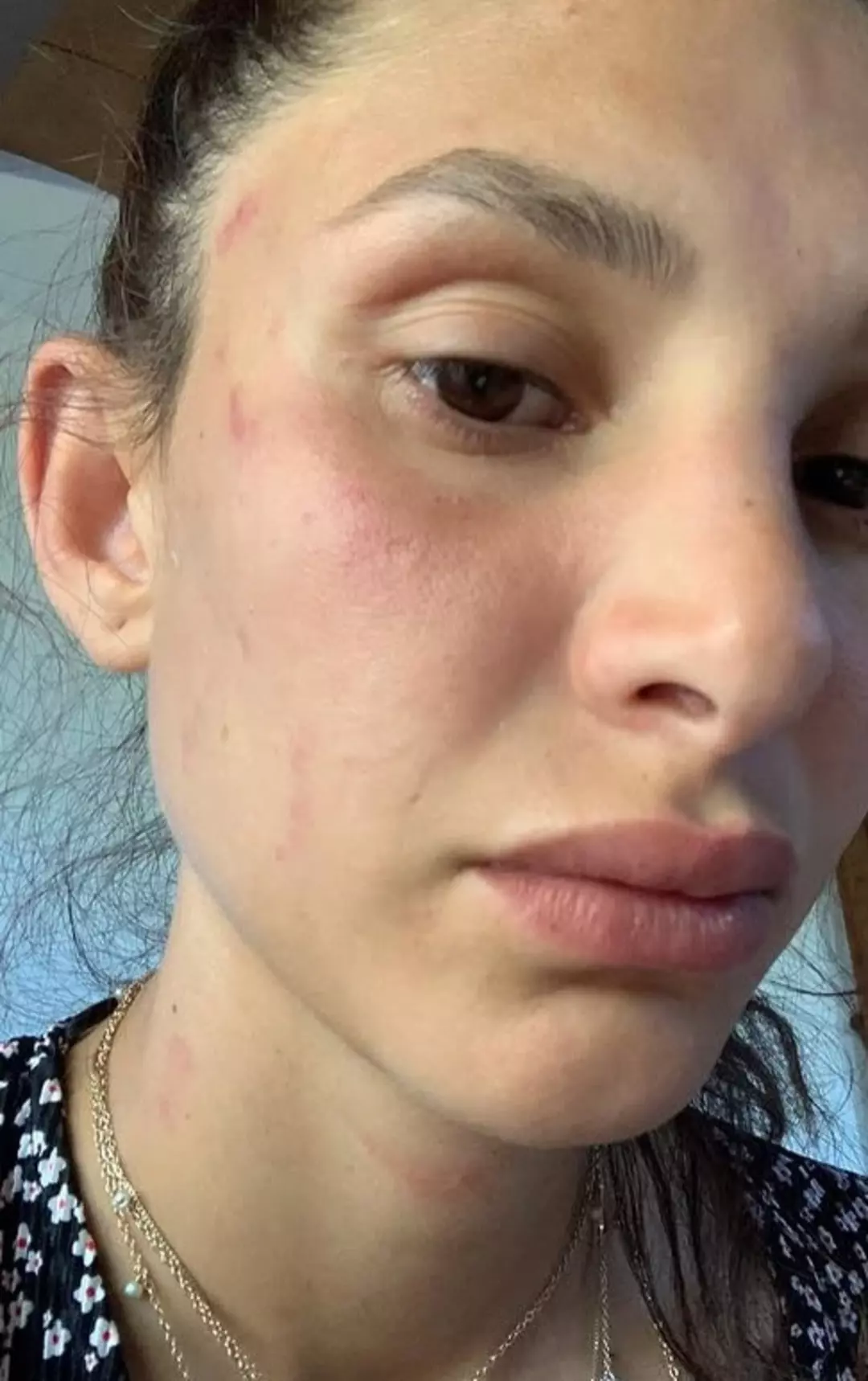 can yamanin sevgilisi kanlar icinde paylasti fiziksel ve psikolojik siddet gordum 1 uClcLk85