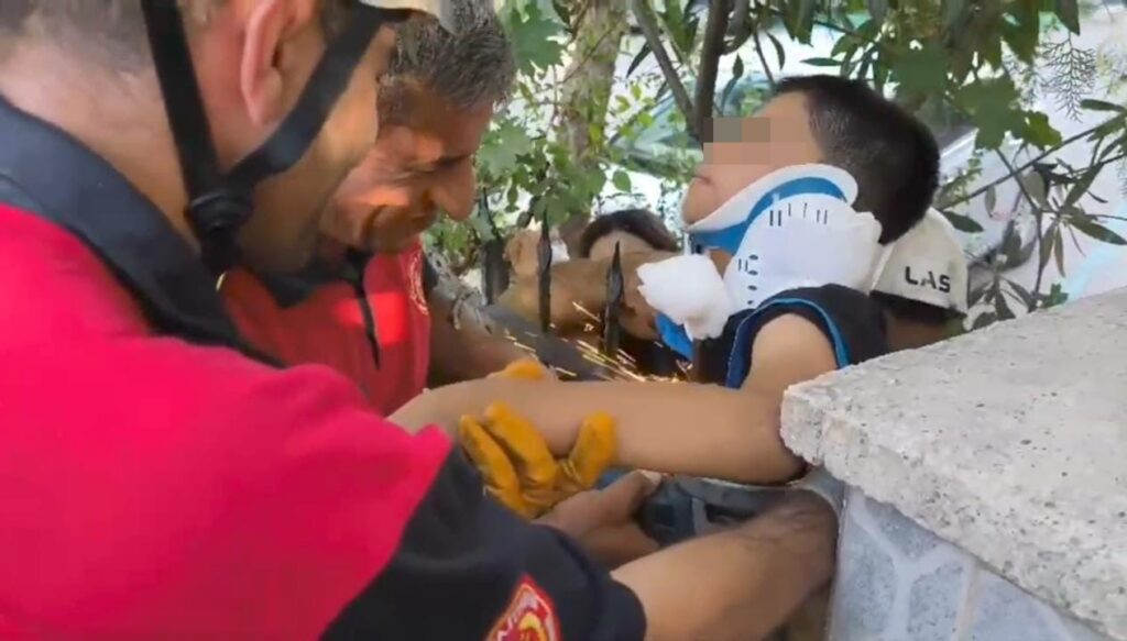 Demir korkuluk çocuğun koluna saplandı 1 demir korkuluk cocugun koluna saplandi sWGe5LRq