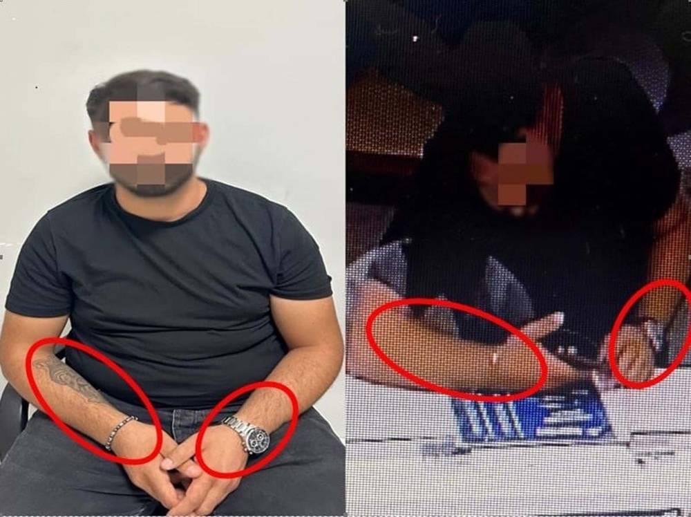 dolandirici kolundaki izden yakayi ele verdi 0 I765Z8Yc