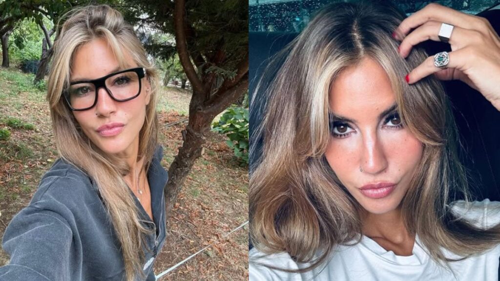 cagla sikelden dikkat ceken paylasim bacaklarindaki morluklar akillarda soru isareti yaratti 8vLdJBXE