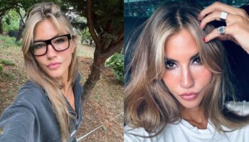 cagla sikelden dikkat ceken paylasim bacaklarindaki morluklar akillarda soru isareti yaratti 8vLdJBXE