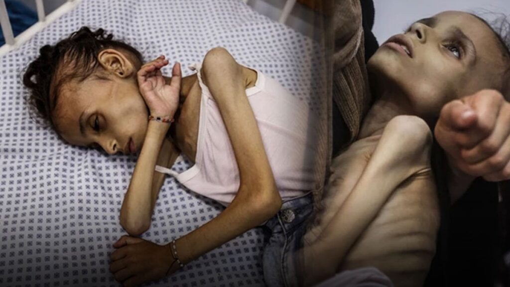 gazzedeki insanlik drami derinlesiyor 9 yasindaki meryem 10 kiloya dustu PuPfWcNh