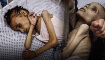gazzedeki insanlik drami derinlesiyor 9 yasindaki meryem 10 kiloya dustu PuPfWcNh