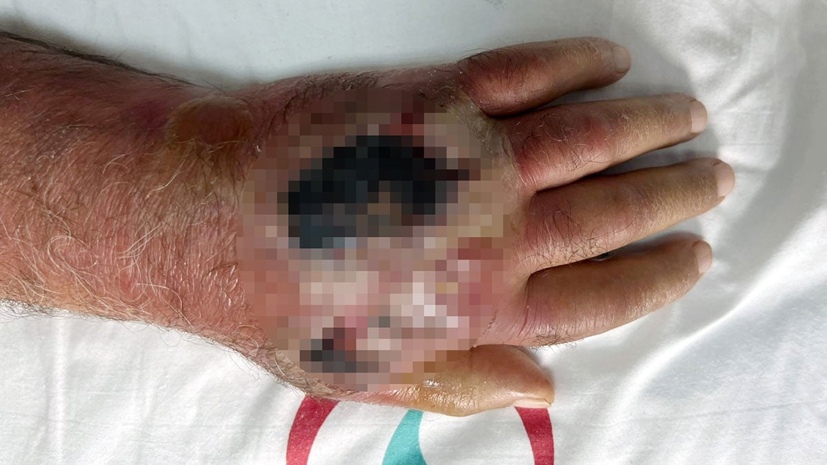 hirsiz isirigi az daha kolundan ediyordu 0 lesacP7e