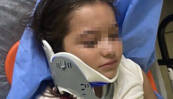 orduda ters seritten gelen scooter 8 yasindaki cocuga carpti Uqqamub9