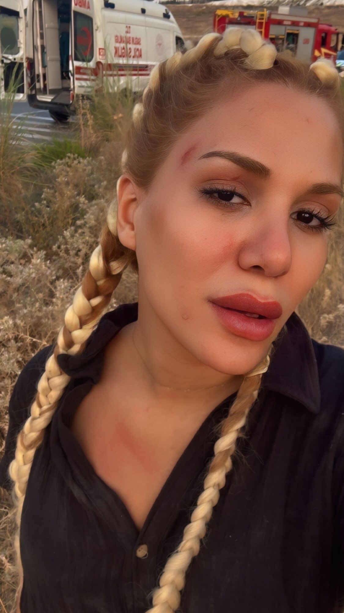 survivor almeda baylan olumden dondu araci taklalar atip ucuruma yuvarlandi 0 alZyYeQB