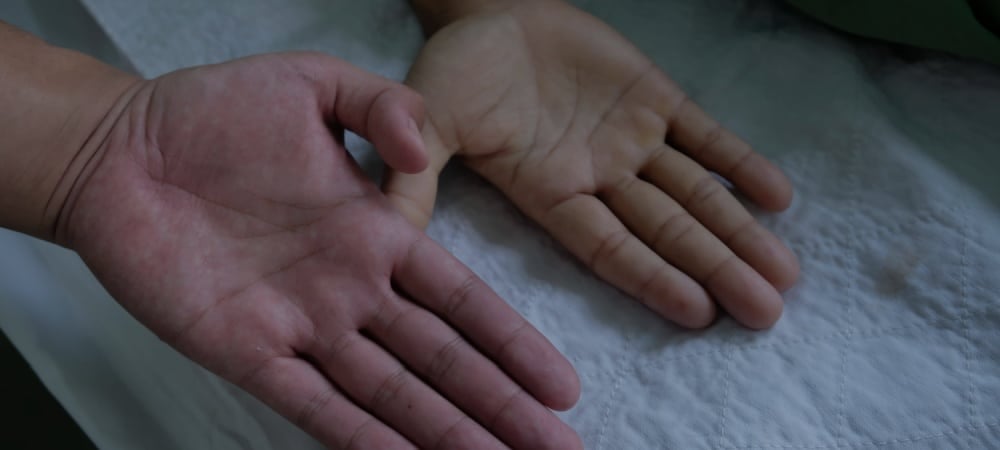 demir eksikliginin gizli yuzu vucudun alarmi 0 7QS27w1K