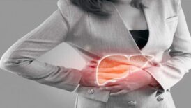 her lokmasi olum getiriyor karacigeri yaglandiriyor damarlari tikiyor ve omru kisaltiyor 6WEk7lcM
