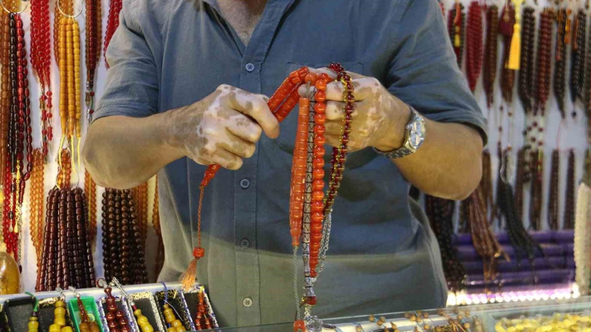 sasirtan durum fiyati 10 bin dolari bulabiliyor kendi aralarinda ticaret yapiyorlar 0 rClfkh92