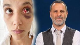 taciz ifsalari surerken topa tutulmustu ozan guven projeden apar topar ayrildi 2UgneBbW