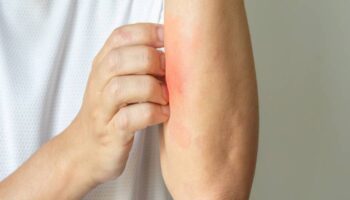 yeni ve sinsi salgin tehdidi uzmanlar uyardi 8s5LDsbO