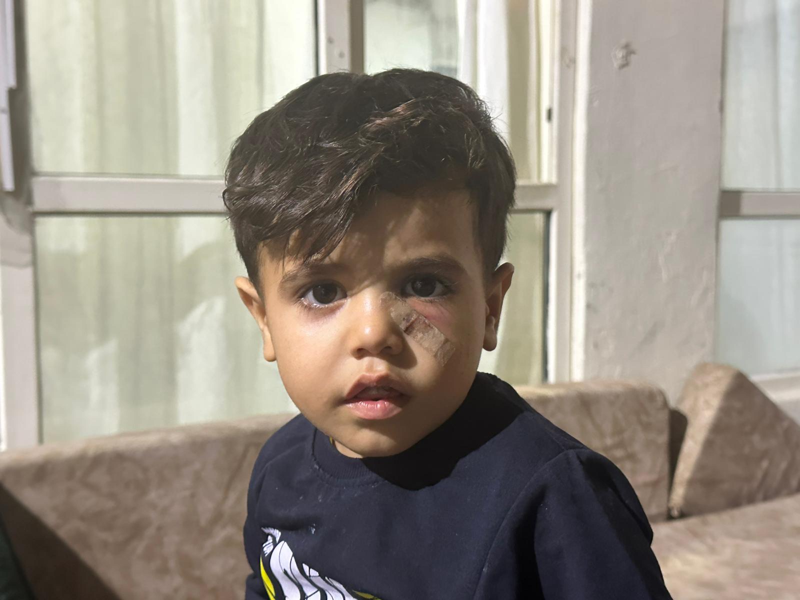 oyun oynarken olumle burun buruna gozunden vuruldu polis magandayi ariyor 1 RZqJeevt