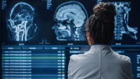 beynin yikimini hizlandiran iki tehlikeyi uzmanlar anlatti YTlwLvTb