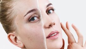 bisturi yok filtre yok daha genc gorunmenin 5 altin adimi A9lXNPFi