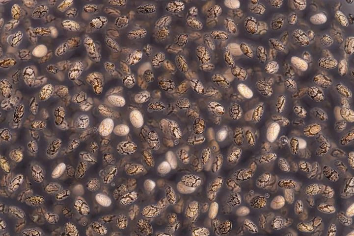 genclerde kolon kanseri alarmi neden artiyor iste bagirsaklarin en iyi dostlari 11 VsQrjpHL