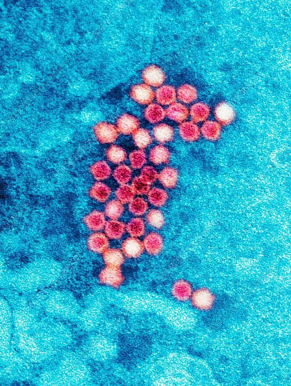 kisin yeni dusmani bocavirus cocuklari tehdit ediyor atesle baslayip olume gidiyor 11 AMFYfkny