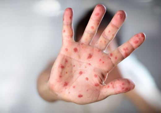 sakin bitti sanmayin zona yillar sonra geri dondu 4 mAaNwGLQ