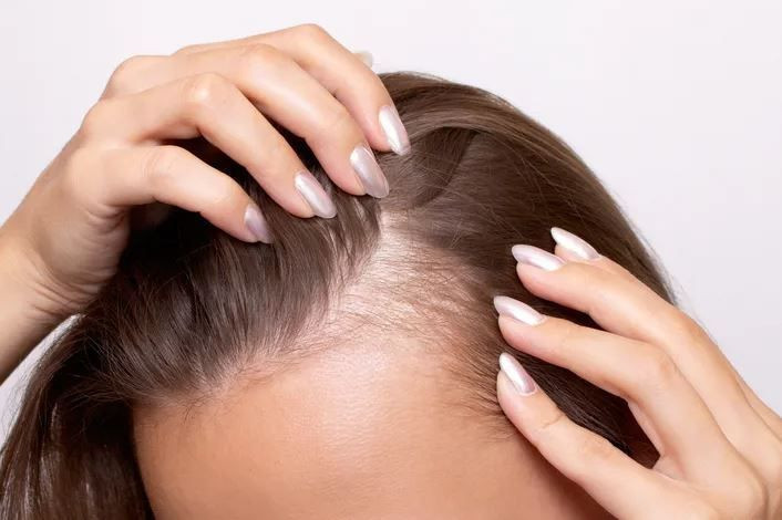 sampuana ekleyin farki aynada gorun tek damlasi yetiyor uyuyan sac koklerini uyandiriyor 3 ZbEdLTMw