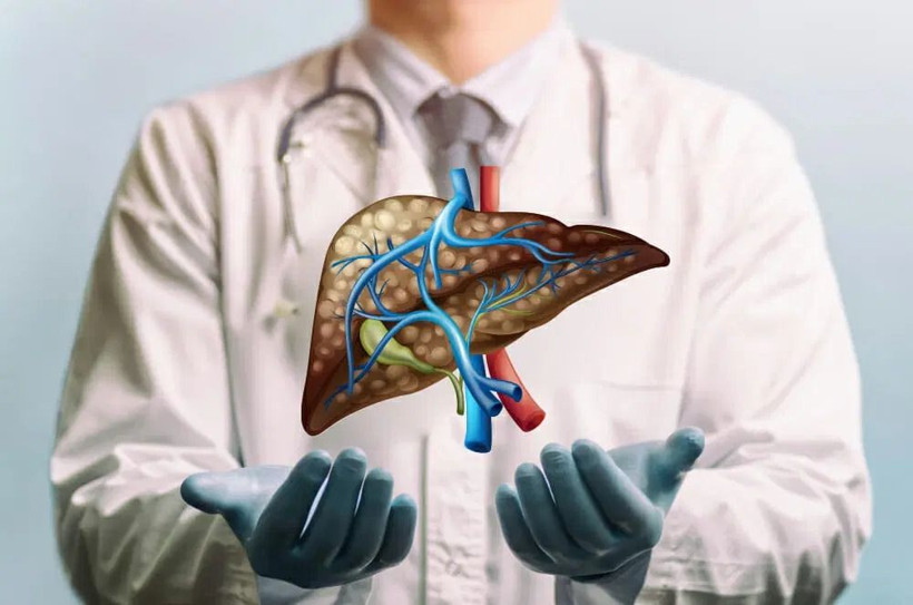 sirozun gizli tehlikesi ortaya cikti alkolu birakmazsaniz geri donulmez oluyor 4