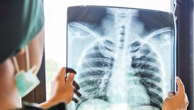 zaturre tedavisinde 4 saat kurali ortaya cikti TseM4liv