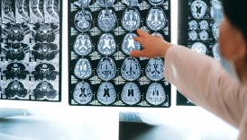 beyin gelisimini rehin alan besinler kasikla gelen tehlike vR1Rxsnm