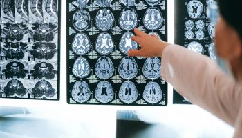 beyin gelisimini rehin alan besinler kasikla gelen tehlike vR1Rxsnm