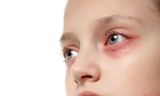 goz kasintisini hafife almayin nedeni bir parazit olabilir 0 g5EwJfB5