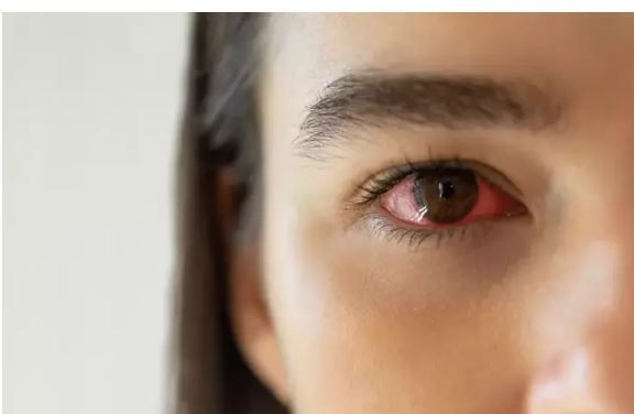 goz kasintisini hafife almayin nedeni bir parazit olabilir 3 LZ5VZB6G