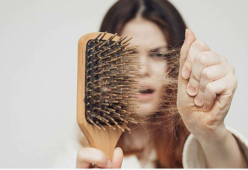 kadinlarda sac dokulmesinin gizli nedenleri ortaya cikti 2 Y4e8PfRi